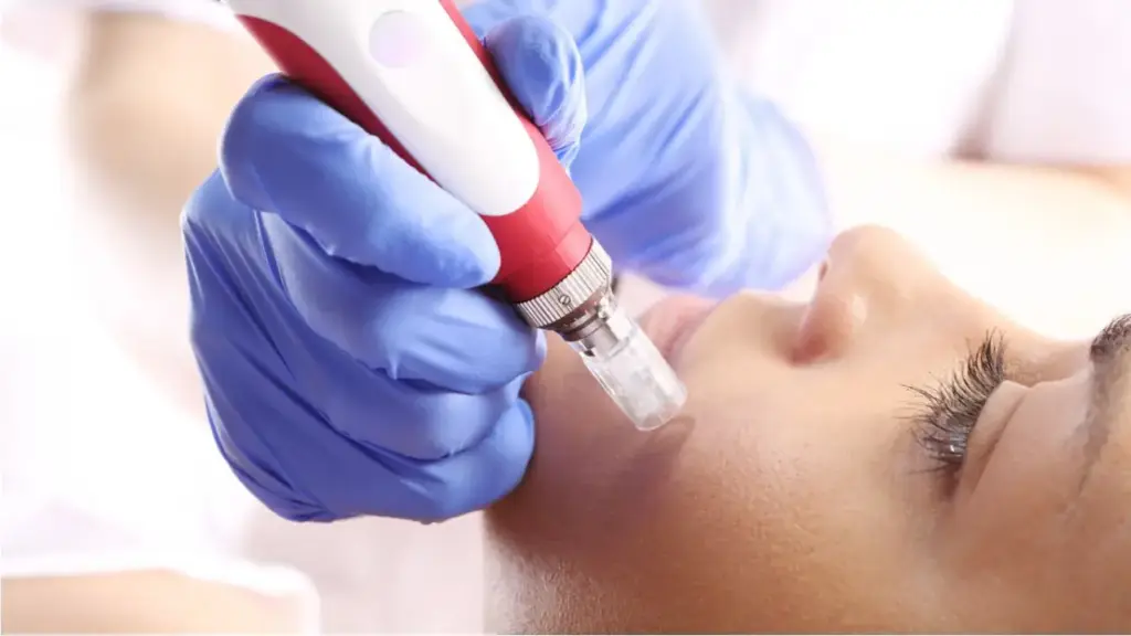 apa itu rawatan microneedling