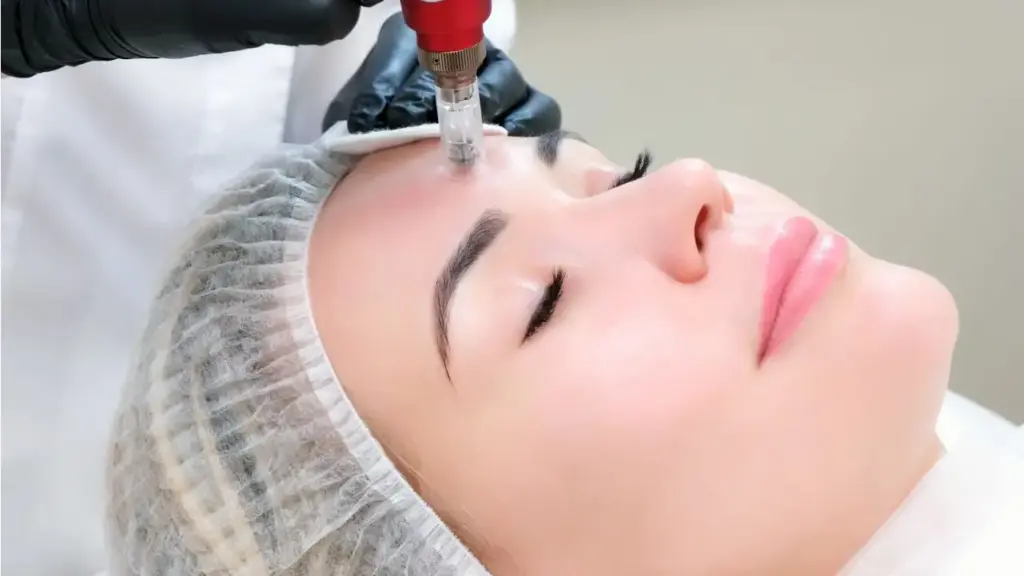 faktor-faktor yang mempengaruhi kos rawatan microneedling