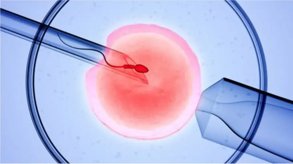 kepentingan rawatan ivf di malaysia