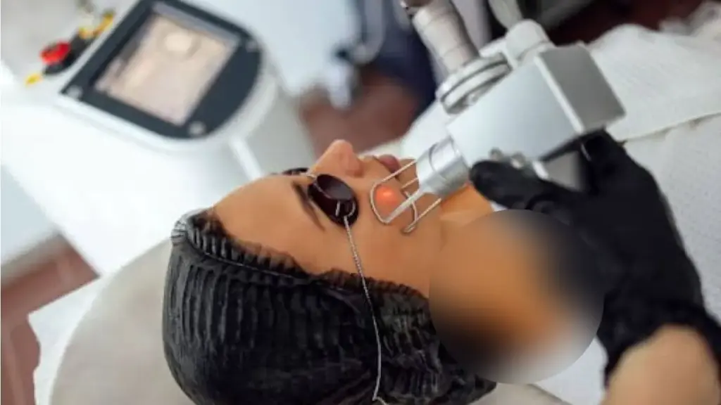 langkah-langkah mendapatkan rawatan microneedling
