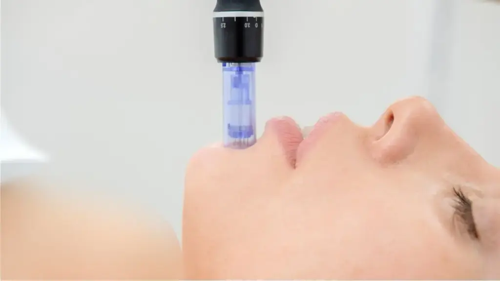 panduan memilih klinik rawatan microneedling di malaysia