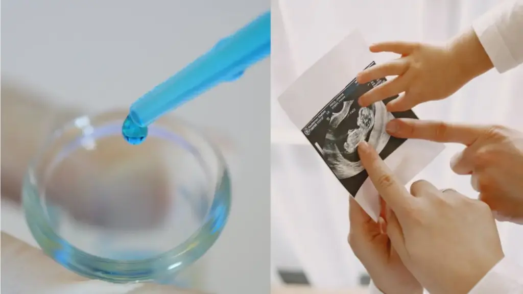 perbandingan kos rawatan ivf mengikut institusi