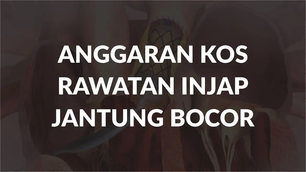 anggaran kos rawatan injap jantung bocor terkini di malaysia